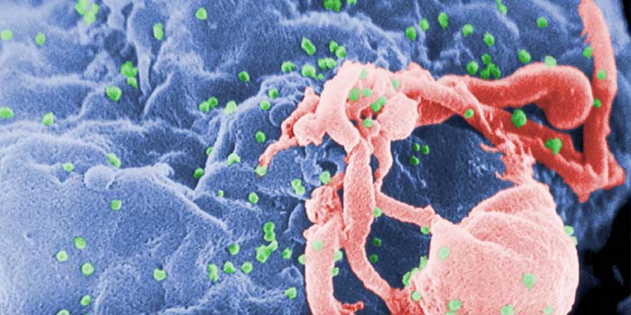 1 Eiwit kan HIV-virus vernietigen
