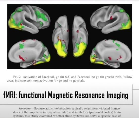 functionele magnetische resonantie beeldvorming (fMRI)